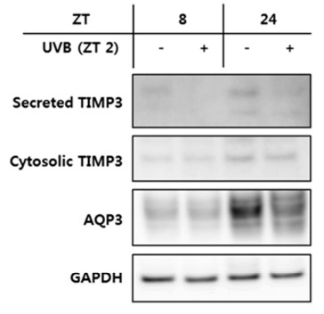 The secreted or cytosolic TIMP3 and aquaporin 3 (AQP3) were examined.jpg